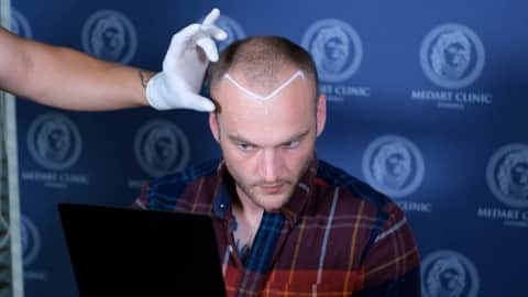 MedArt Hair - Patient Photo