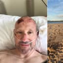 Mark Hanlon in hospital following the incident and pictured more recently at a beach.