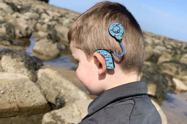 Having the fun Hearoes stickers on a cochlear implant or hearing aid can help encourage children to wear them.