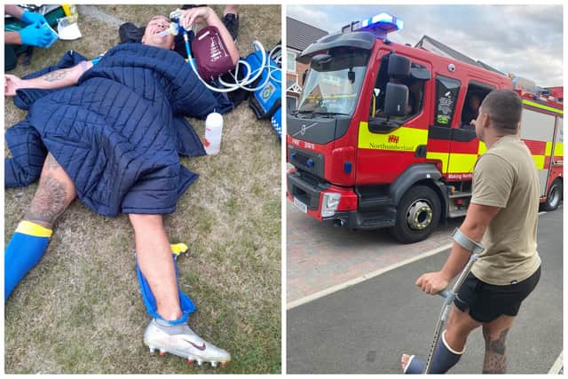 Cory recovered quickly from his rugby injury thanks to help from The Fire Fighters Charity.