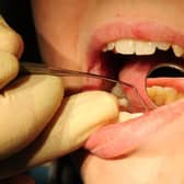 Huge drop in dentist visits