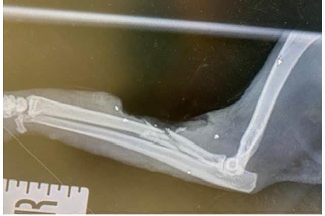 An X-ray shows the break.