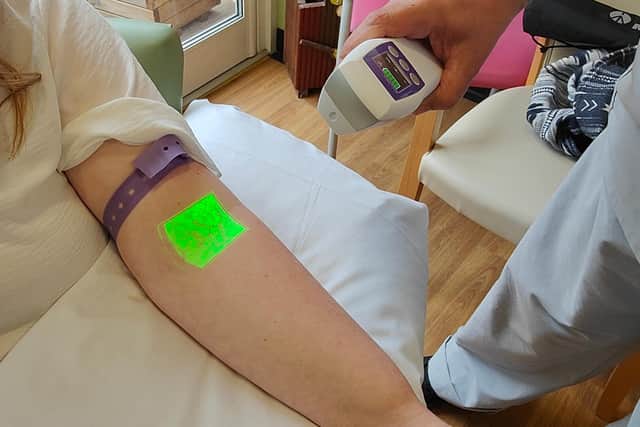 The new vein scanner is used on Terri's arm in order to help with the IV insertion process.