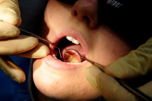 Huge challenges face under 18 dental treatment