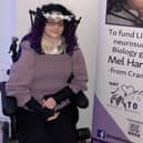 Melanie Hartshorn needs help to pay for an operation which, she says, will save her life.