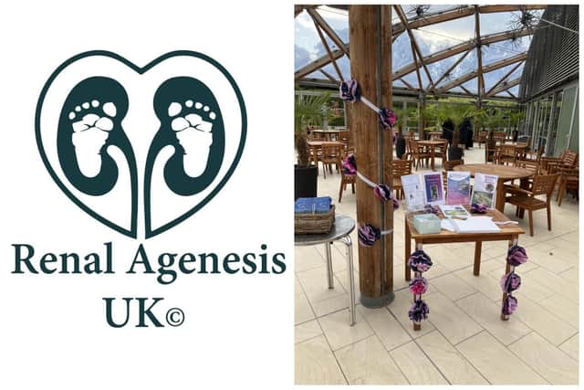 Renal Agenesis are coming back to The Alnwick Garden again after last year's successful collaboration.