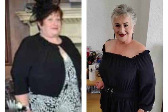Loraine before and after losing weight.