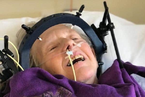 Sandra Lonsdale's injuries included a fractured neck, broken ribs, a broken leg, a crushed heel joint, a displaced kneecap and degloving of her right arm.