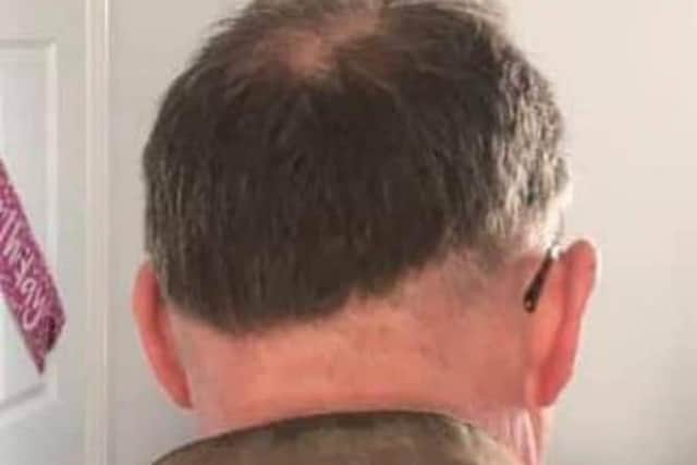 The worst covid cut went to Andrea Taylor for sending in her photo of her husband Gordon’s attempt on his own hair.