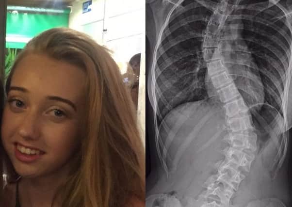 A funding campaign has started to help Lucy Huddleston receive pioneering back treatment in the US.